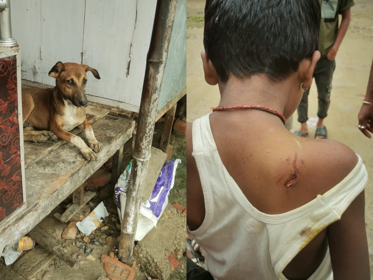 धनुषामा कुकुरको टोकाइबाट २२ जना घाईते