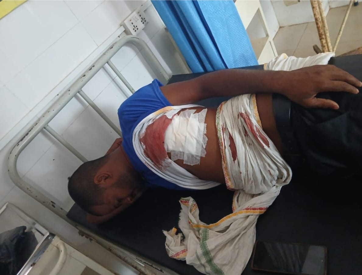 रौतहटको मौलापुरमा छुरा प्रहार, एक जना घाइते