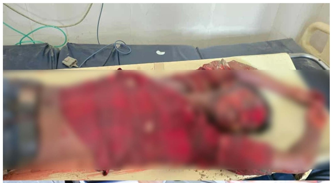 रौतहटमा अज्ञात युवकको छुरा प्रहार गरी हत्या, एक जना पक्राउ