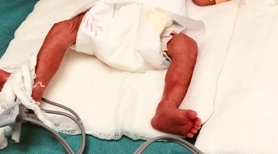 अरनिको अस्पतालमा शौचालयभित्र सालनालसहितको शिशु फेला