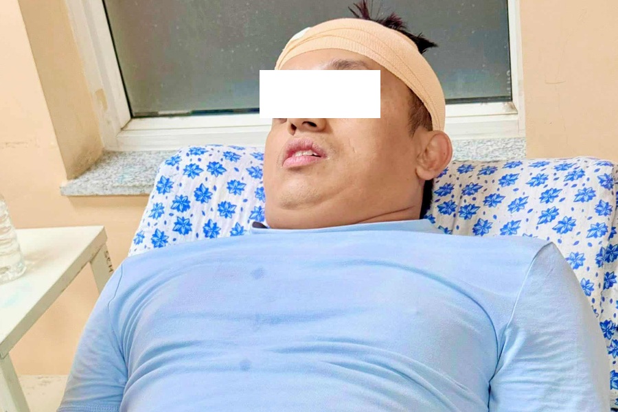 रास्वपा नेता भण्डारीमाथि आक्रमण