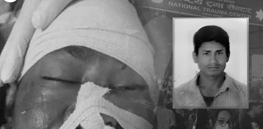 ट्रमा सेन्टरमा उपचाररत गम्भीर घाइते राईको मृत्यु