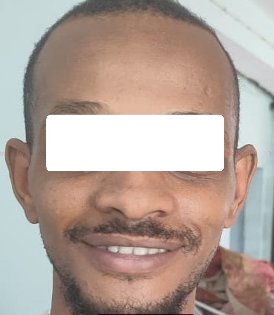 नेपाल-भारत सीमास्थित रक्सौल नाकामा एक सुडानी नागरिक पक्राउ