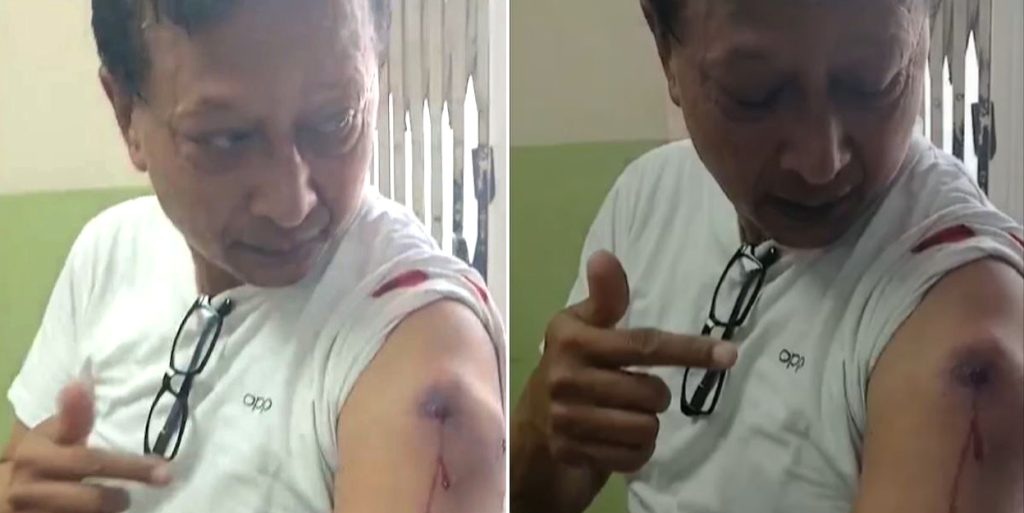 प्रहरीको गोली लागेर कान्तिपुर टिभीका पत्रकार श्रेष्ठ घाइते