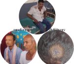 सन्तपुर कुटपिट प्रकरण: एक पक्षीय मुद्दा दर्ता गरेको भन्दै प्रहरीविरुद्ध आरोप