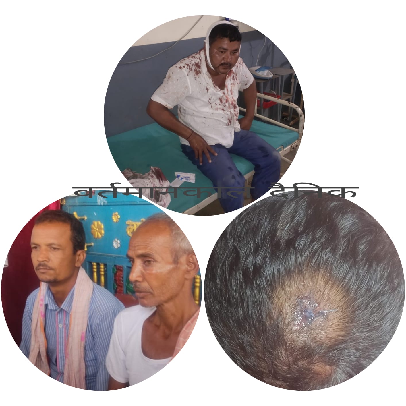 सन्तपुर कुटपिट प्रकरण: एक पक्षीय मुद्दा दर्ता गरेको भन्दै प्रहरीविरुद्ध आरोप