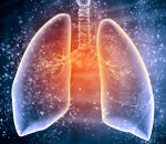 सुदूरपश्चिममा क्षयरोगको समस्या बढ्दै, ६५ जनाको मृत्यु