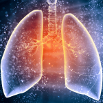 सुदूरपश्चिममा क्षयरोगको समस्या बढ्दै, ६५ जनाको मृत्यु