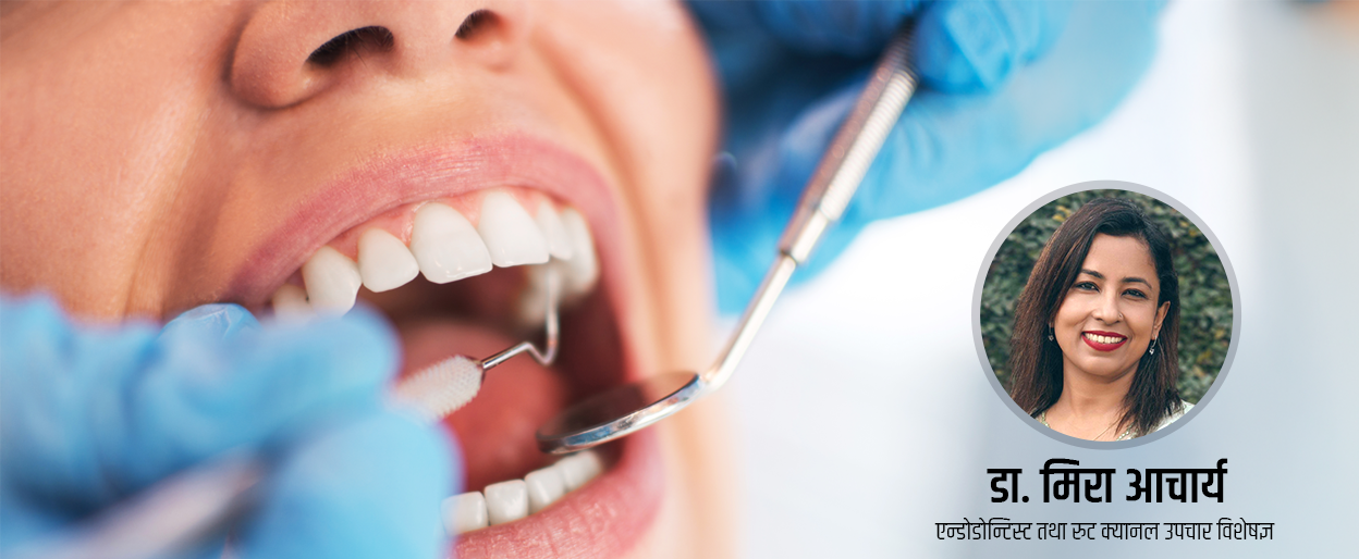 स्वास्थ्य बीमा: दाँत र मुखको उपचारमा के-के सेवा पाइन्छ ?