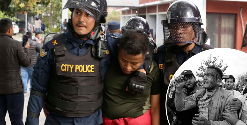 प्रहरी–एमाले प्रदर्शनकारी झडप: एकको टाउको फुट्यो