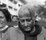 प्रहरीको लाठीचार्जबाट एमाले कार्यकर्ता घाइते, अस्पताल भर्ना