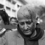 प्रहरीको लाठीचार्जबाट एमाले कार्यकर्ता घाइते, अस्पताल भर्ना