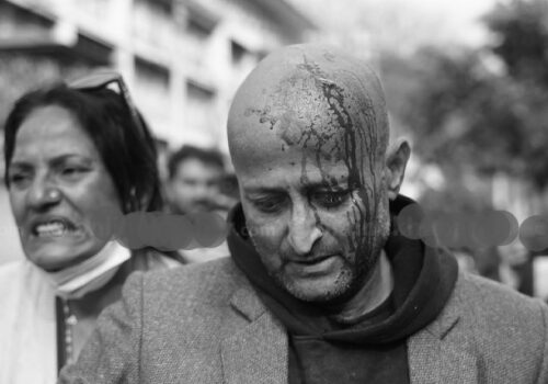 प्रहरीको लाठीचार्जबाट एमाले कार्यकर्ता घाइते, अस्पताल भर्ना