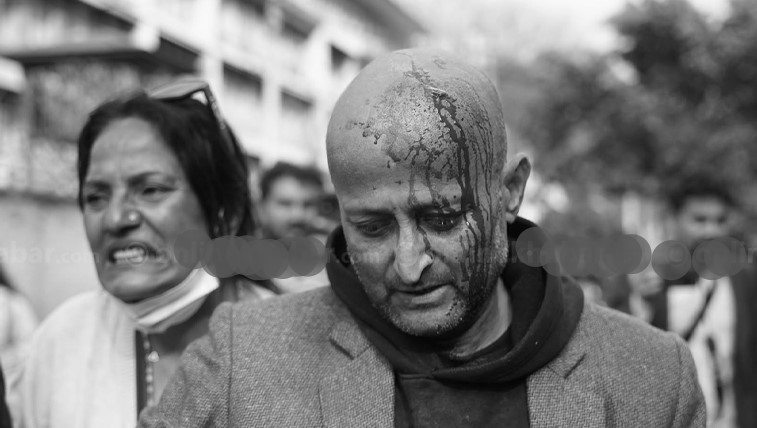 प्रहरीको लाठीचार्जबाट एमाले कार्यकर्ता घाइते, अस्पताल भर्ना