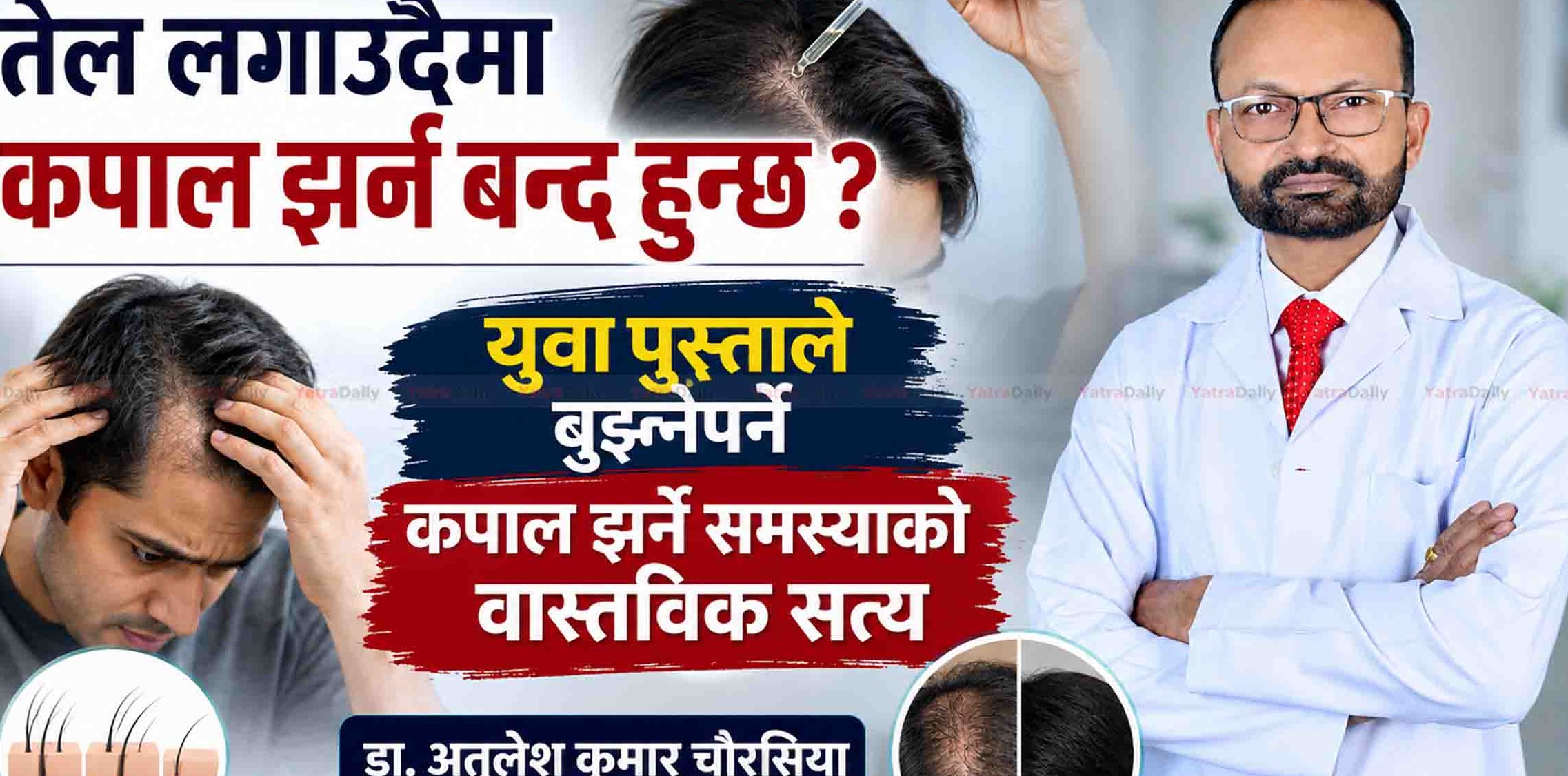कपालमा तेल लगाउँदैमा झर्न बन्द हुन्छ ? जान्नैपर्ने वास्तविकता
